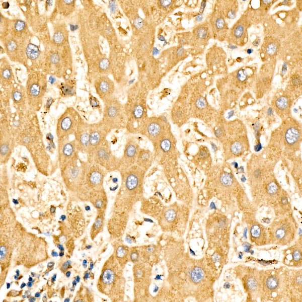 SLC27A6 Rabbit Polyclonal Antibody