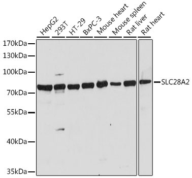 SLC28A2 Rabbit Polyclonal Antibody