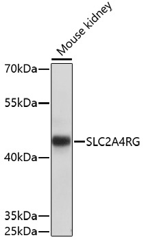 SLC2A4RG Rabbit Polyclonal Antibody