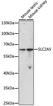 SLC2A5 Rabbit Polyclonal Antibody