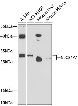 SLC31A1 Rabbit Polyclonal Antibody