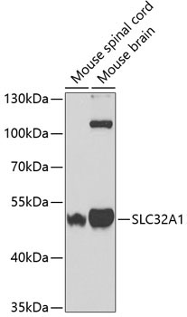 SLC32A1 Rabbit Polyclonal Antibody