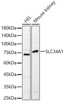 SLC34A1 Rabbit Polyclonal Antibody