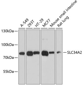 SLC34A2 Rabbit Polyclonal Antibody