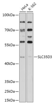 SLC35D3 Rabbit Polyclonal Antibody