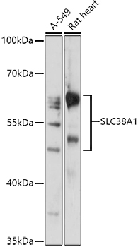 SLC38A1 Rabbit Polyclonal Antibody