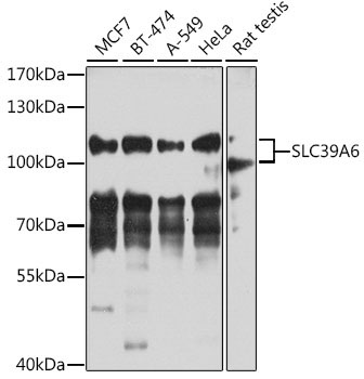 SLC39A6 Rabbit Polyclonal Antibody
