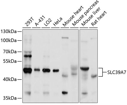SLC39A7 Rabbit Polyclonal Antibody