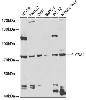 SLC3A1 Rabbit Polyclonal Antibody