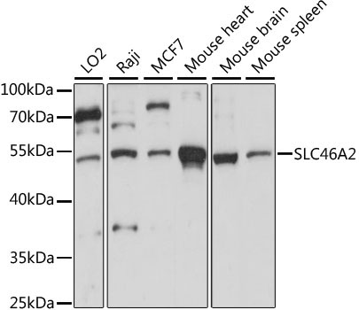SLC46A2 Rabbit Polyclonal Antibody
