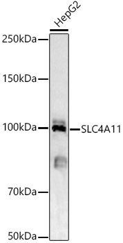 SLC4A11 Rabbit Polyclonal Antibody