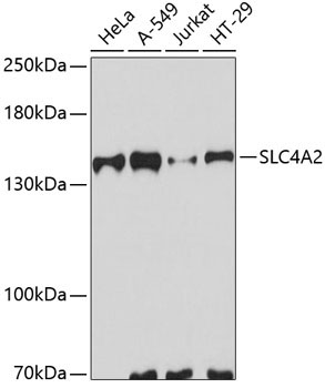 SLC4A2 Rabbit Polyclonal Antibody
