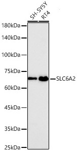SLC6A2 Rabbit Monoclonal Antibody