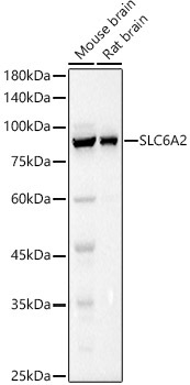 SLC6A2 Rabbit Polyclonal Antibody