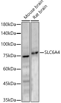 SLC6A4 Rabbit Polyclonal Antibody