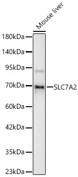 SLC7A2 Rabbit Polyclonal Antibody