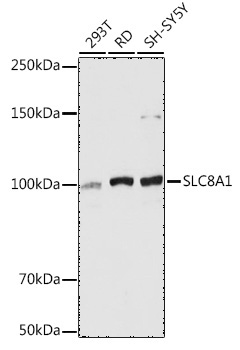 SLC8A1 Rabbit Polyclonal Antibody