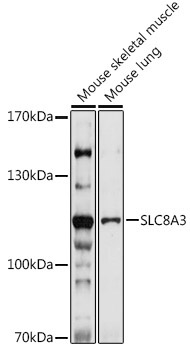 SLC8A3 Rabbit Polyclonal Antibody