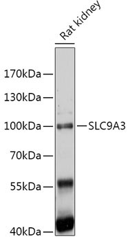 SLC9A3 Rabbit Polyclonal Antibody