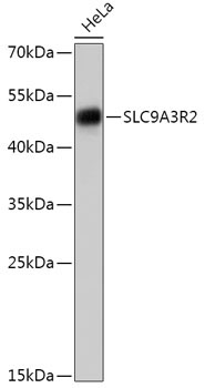 SLC9A3R2 Rabbit Polyclonal Antibody