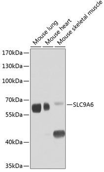 SLC9A6 Rabbit Polyclonal Antibody