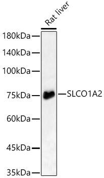 SLCO1A2 Rabbit Polyclonal Antibody