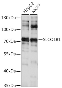 SLCO1B1 Rabbit Polyclonal Antibody