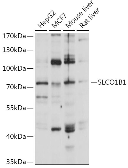 SLCO1B1 Rabbit Polyclonal Antibody