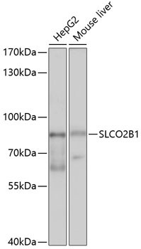 SLCO2B1 Rabbit Polyclonal Antibody