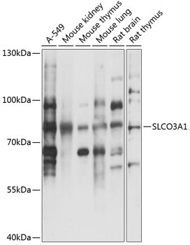 SLCO3A1 Rabbit Polyclonal Antibody