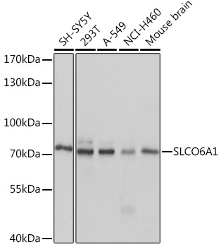 SLCO6A1 Rabbit Polyclonal Antibody
