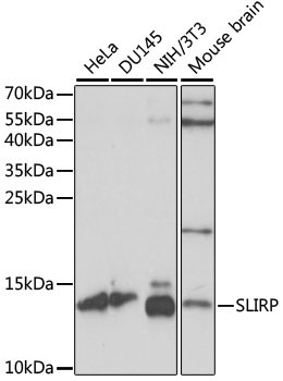 SLIRP Rabbit Polyclonal Antibody