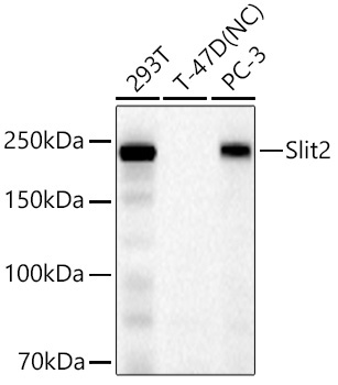 Slit2 Rabbit Monoclonal Antibody