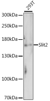 Slit2 Rabbit Polyclonal Antibody