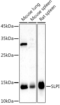 SLPI Rabbit Polyclonal Antibody