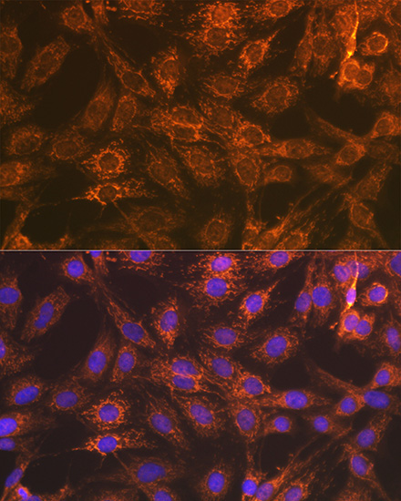 Smac/Diablo Rabbit Monoclonal Antibody - Image 3