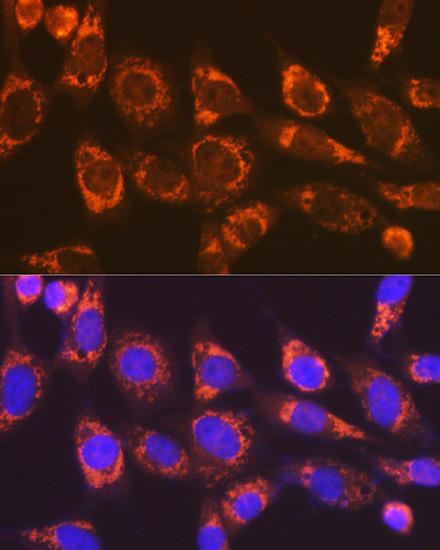 Smac/Diablo Rabbit Monoclonal Antibody - Image 4