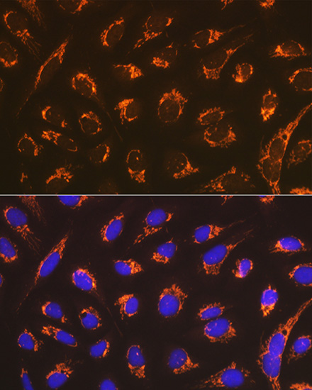 Smac/Diablo Rabbit Monoclonal Antibody - Image 5