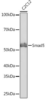 Smad5 Rabbit Monoclonal Antibody - Image 2