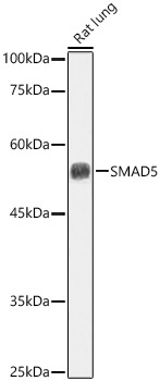 Smad5 Rabbit Polyclonal Antibody