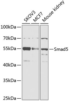 Smad5 Rabbit Polyclonal Antibody
