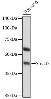 Smad5 Rabbit Polyclonal Antibody