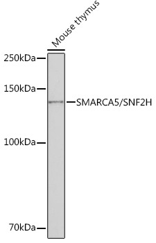 SMARCA5/SNF2H Rabbit Monoclonal Antibody - Image 2