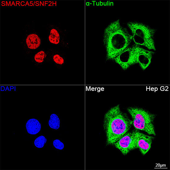 SMARCA5/SNF2H Rabbit Monoclonal Antibody - Image 3