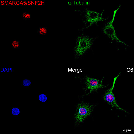 SMARCA5/SNF2H Rabbit Monoclonal Antibody - Image 4