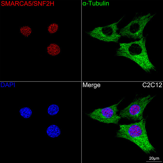 SMARCA5/SNF2H Rabbit Monoclonal Antibody - Image 5