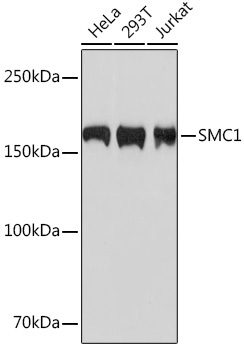 SMC1 Rabbit Monoclonal Antibody