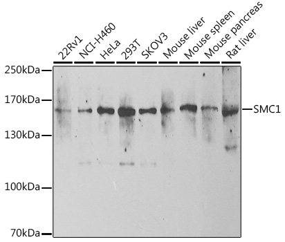 SMC1 Rabbit Polyclonal Antibody