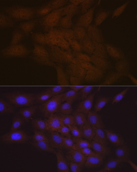 SMC4 Rabbit Monoclonal Antibody - Image 2