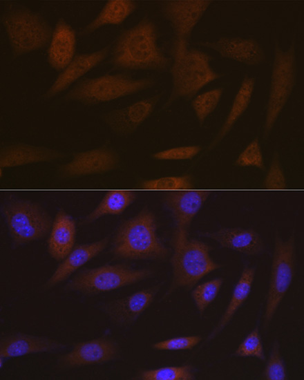 SMC4 Rabbit Monoclonal Antibody - Image 3